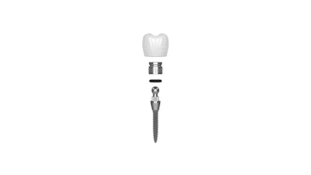 Mini-Dental-Implant-Tampa-Bay-Mini-Dental-Implant-Solutions-Luz-Cabrera-DMD