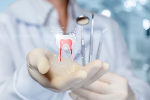 Tratamiento de conducto | Tampa Bay Mini Dental Implant Solutions