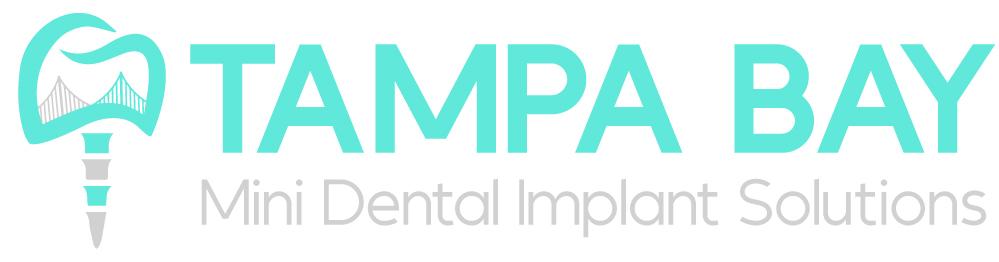 Tampa Bay Mini Dental Implant Solutions